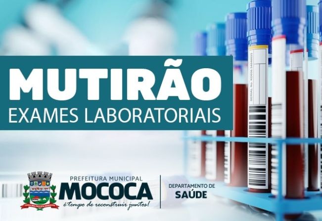 SAÚDE REALIZA MUTIRÃO DE EXAMES LABORATORIAIS. SERÃO MAIS DE 12 MIL EXAMES REALIZADOS 